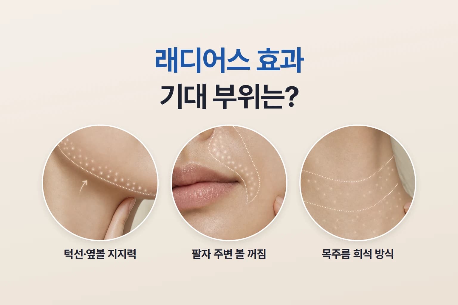 턱선·팔자·목 부위 크롭 사진에 CaHA 입자가 작용하는 모습을 표시한 래디어스 효과 부위 썸네일